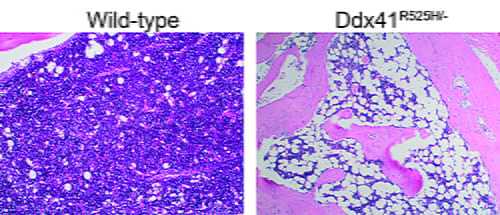 Tim Chlon lab: A section of the bone marrow of a mouse with two mutations in DDX41 compared to normal mouse bone marrow (wild-type).
